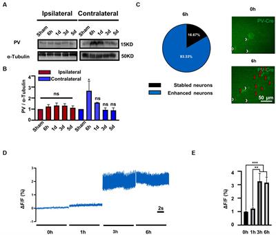 Parvalbumin-positive neurons in the medial vestibular nucleus contribute to vestibular compensation through commissural inhibition